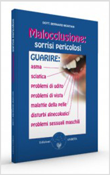 Malocclusione: sorrisi pericolosi di /immagini/libri/malocclusione.jpg
