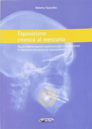 copertina del libro Esposizione cronica al mercurio - outlet di Roberto Facecchia